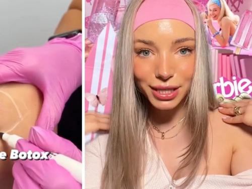 'Barbie Bótox', la última obsesión de belleza en TikTok